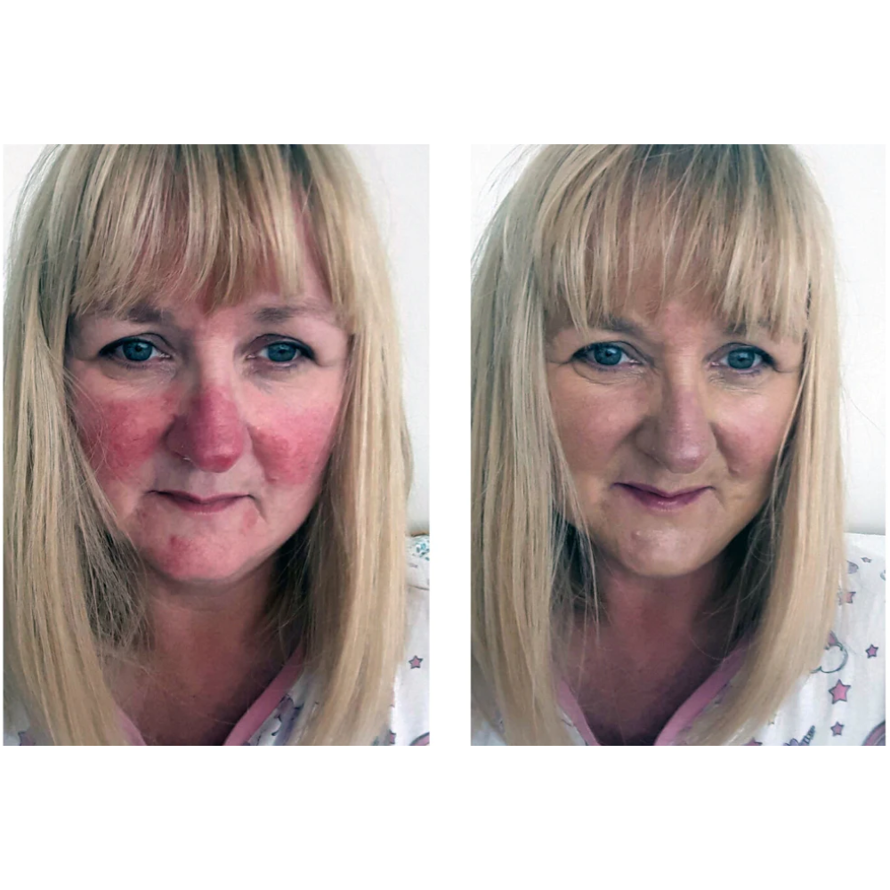 Rosalique 3 in 1 Anti-Redness Miracle Formula SPF50