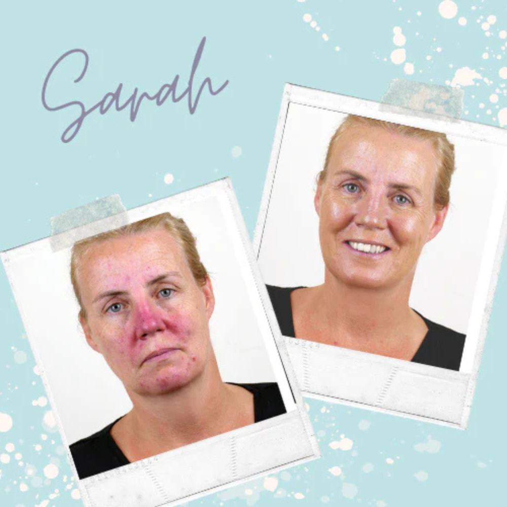 Rosalique 3 in 1 Anti-Redness Miracle Formula SPF50