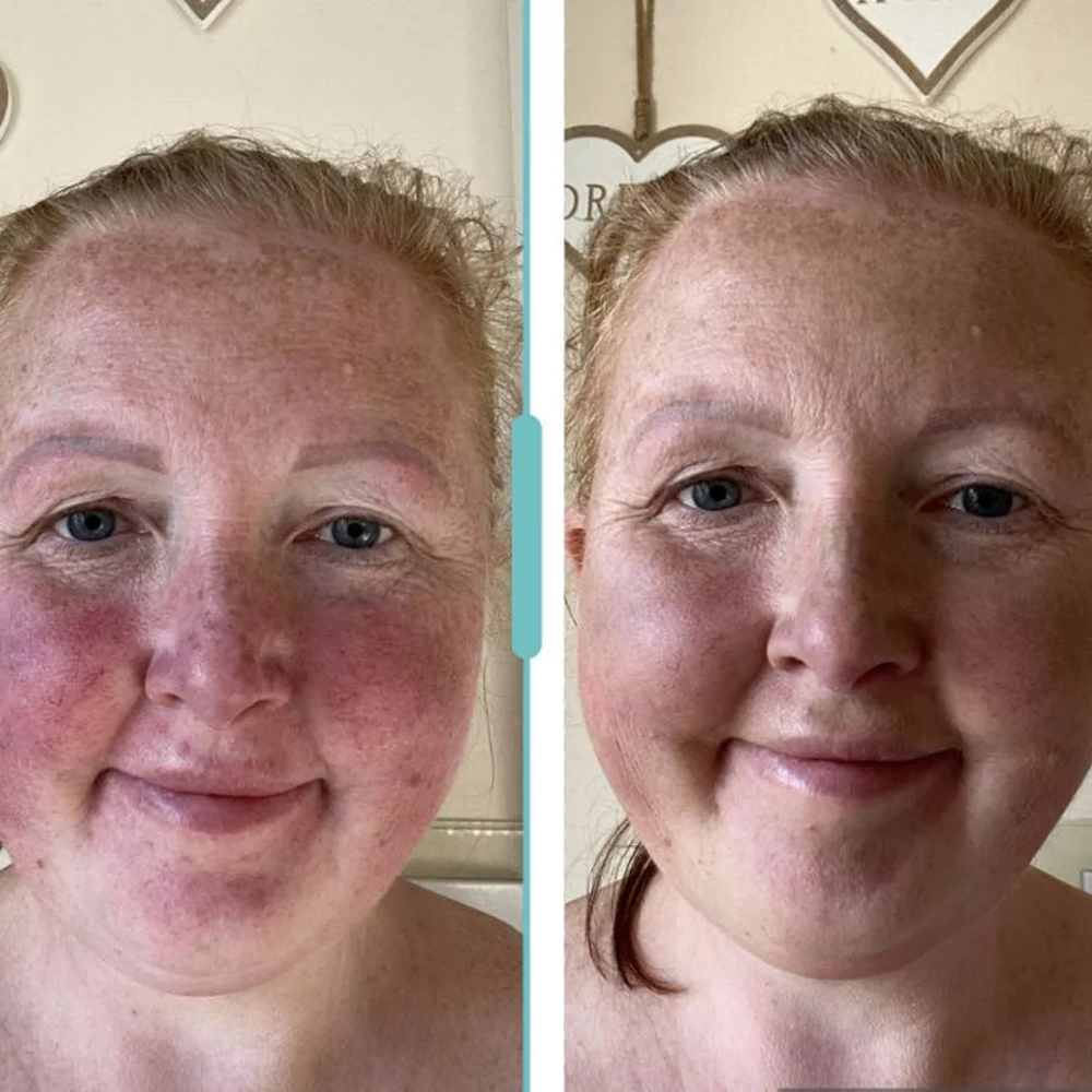 Rosalique 3 in 1 Anti-Redness Miracle Formula SPF50